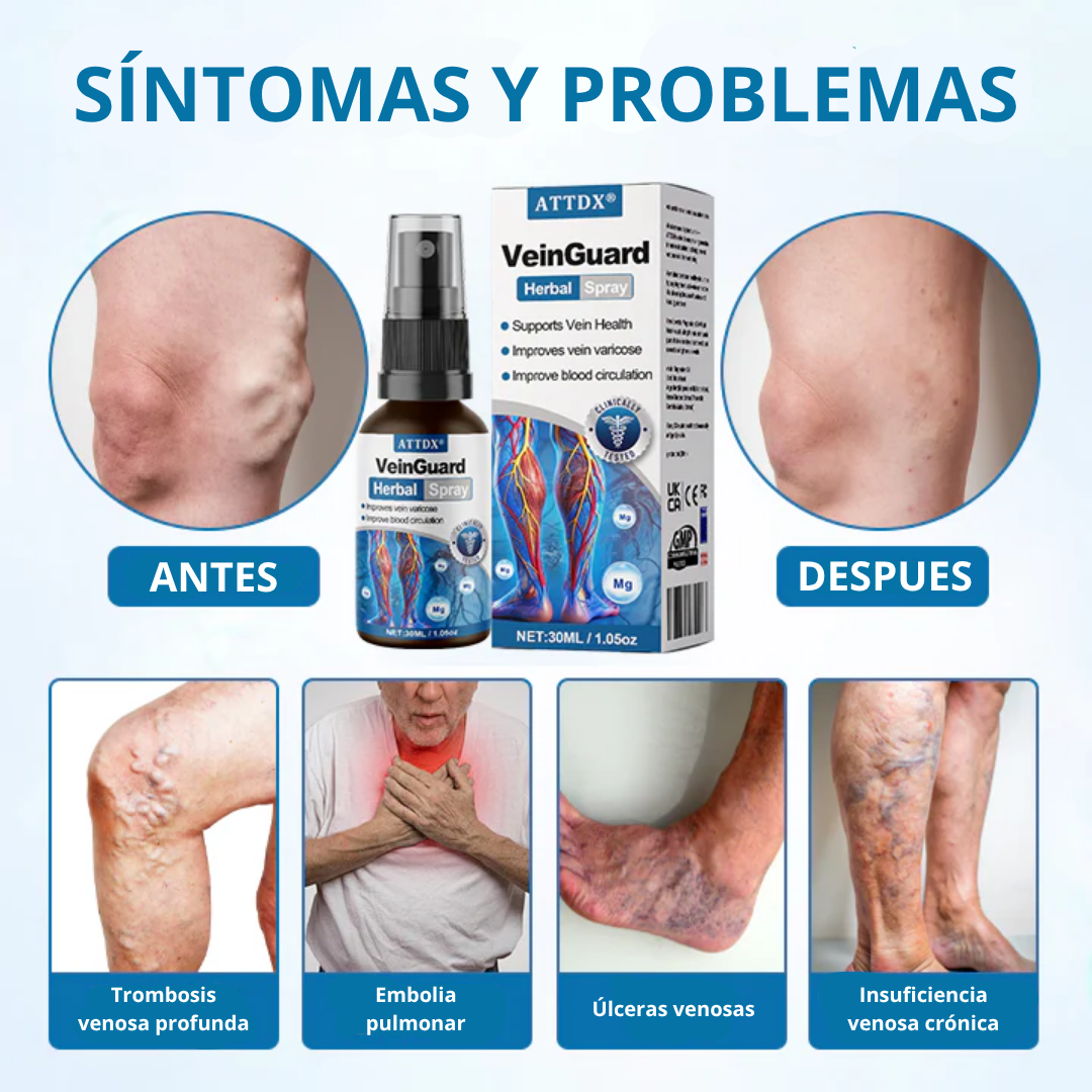 VEINGUARD Herbal Spray 12 1