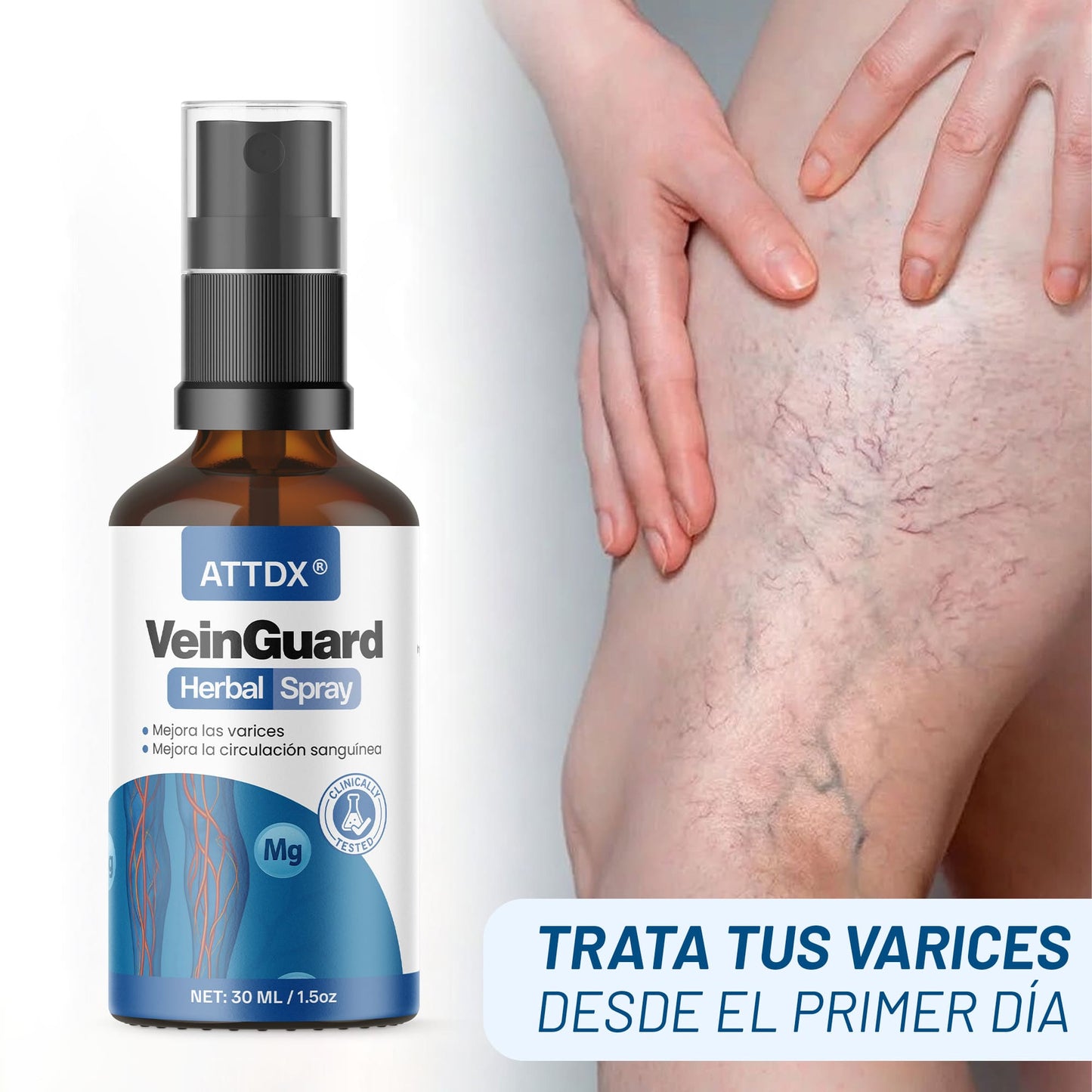 VEINGUARD Herbal Spray: Desinflama y Mejora las Varices y las Arañitas.
